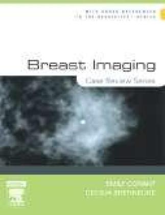 Imagem de Breast imaging: case review - ELSEVIER ED
