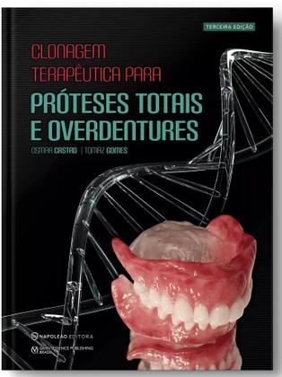 Imagem de Clonagem Terapêutica para Próteses Totais e Overdentures - Napoleão