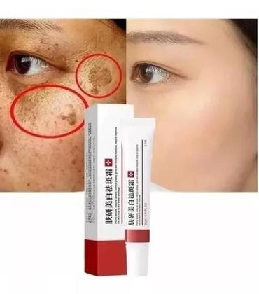 Imagem de Creme Milagroso Clareador Sardas, Melasma Manchas 20g