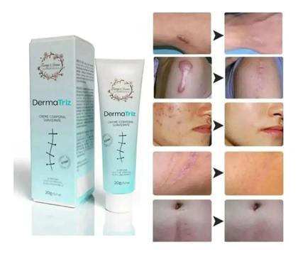 Imagem de Creme Poderoso Suavizante de Cicatriz 20g DermaTriz.