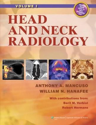 Imagem de Head and neck radiology, 2 vols. - LIPPINCOTT WILLIAMS & WILKINS