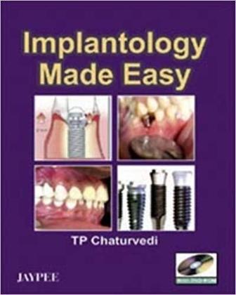 Imagem de Implantology made easy with dvd-rom