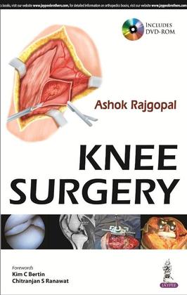 Imagem de Knee Surgery